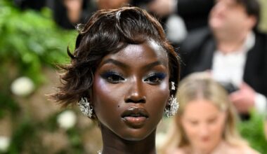 Anok Yai Underwent a ‘Life-Saving’ Procedure for Sepsis