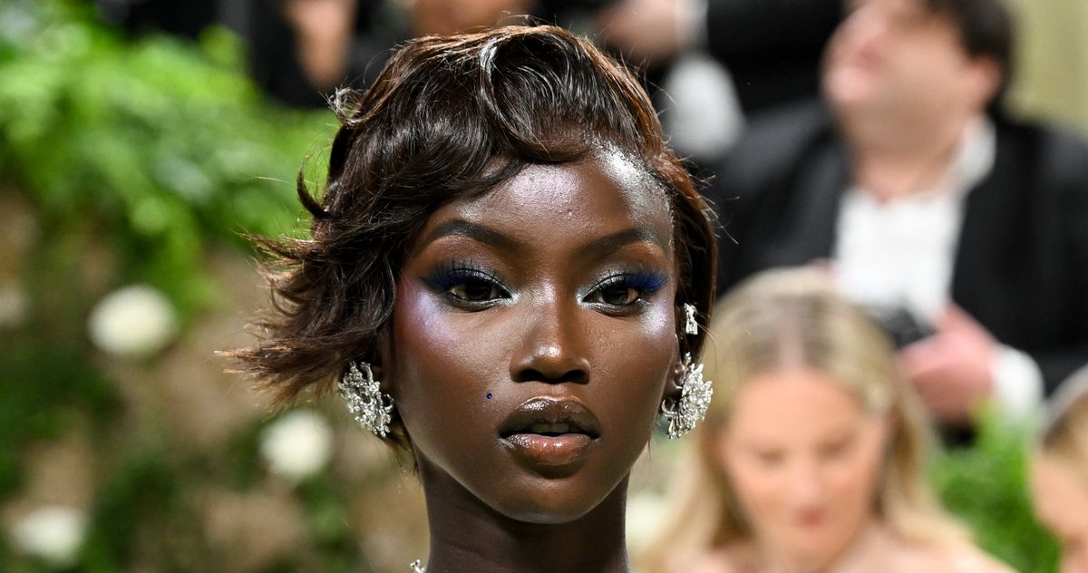 Anok Yai Underwent a ‘Life-Saving’ Procedure for Sepsis