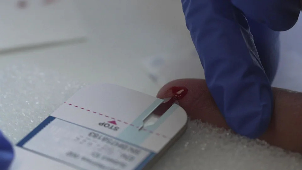 A blue gloved hand holds the finger of a male patient having a finger prick test. The blood is on the finger