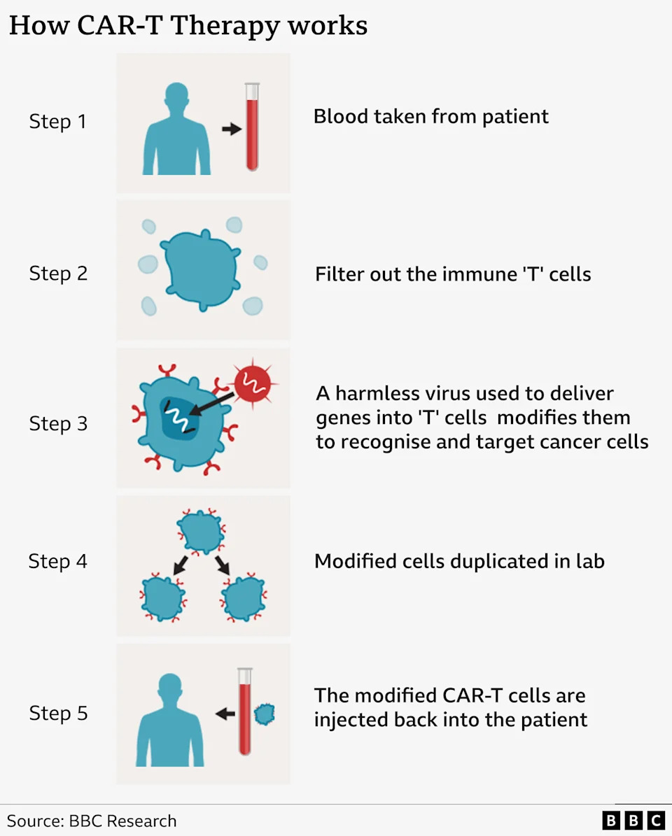 A graphic labelled: How Car-T Therapy works. It shows five illustrated steps of the treatment starting with an blood vial then several images of blue cells.