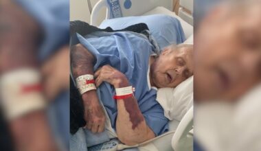 Watchdog calls on Toronto hospital to remove ‘militaristic’ language from security policies