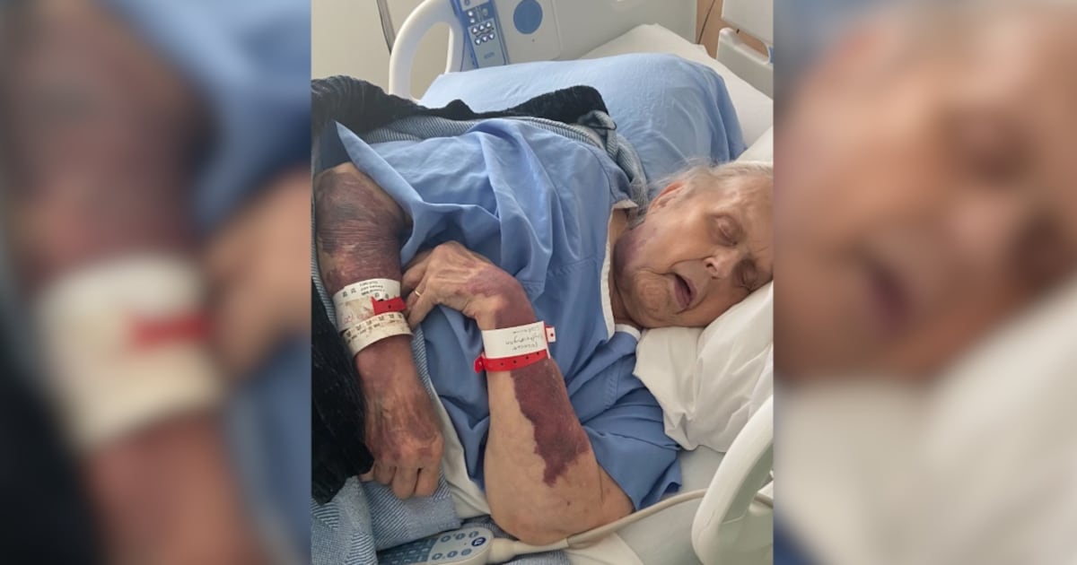 Watchdog calls on Toronto hospital to remove ‘militaristic’ language from security policies