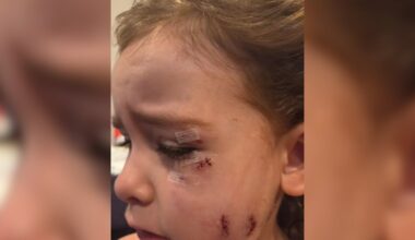 Moms describe attack by dogs that mauled four-year-old girl in Oshawa