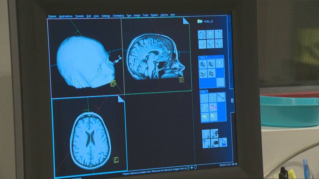 Click to play video: 'Health Matters: Advocate calls for report on mystery New Brunswick brain disease to be retracted'