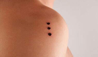 the rise of Kambo frog venom ceremonies