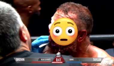 Bare-knuckle war leaves boxer’s face unrecognizable (NSFW)