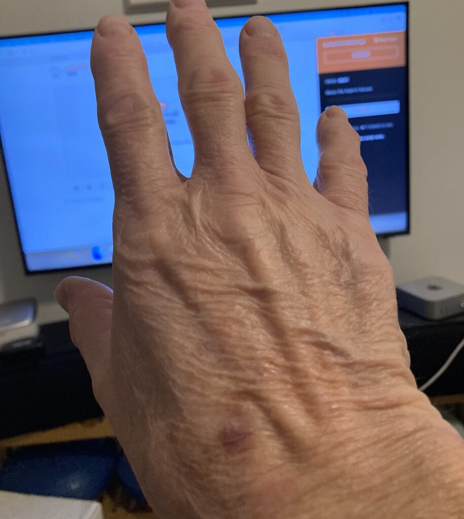 About the Aspirin Excuse