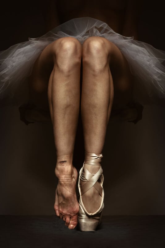 A ballerina’s legs shown from the front, one foot in a pointe shoe and en pointe, the other bare with visible scars and bruises. She wears a white tutu, and the background is dark, highlighting her legs and feet.