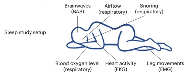 Graphic depicting a sleep study study