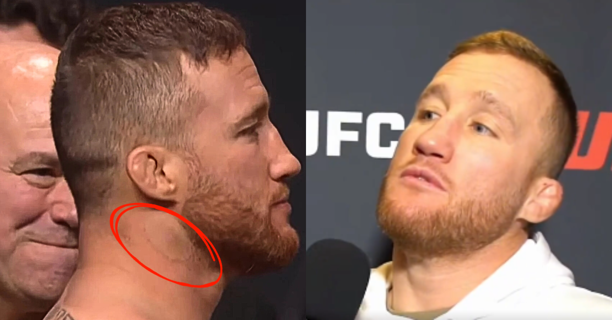 Justin Gaethje Lashes Out at Staph Question: "What's Wrong With You?"