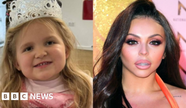 Our children waited too long for same diagnosis as Jesy Nelson’s twins