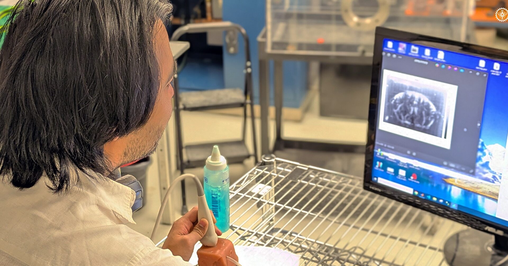 Brain blood circulation is mapped in an unprecedented way, Montreal study finds