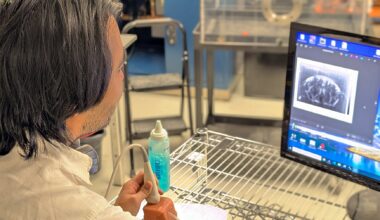 Brain blood circulation is mapped in an unprecedented way, Montreal study finds