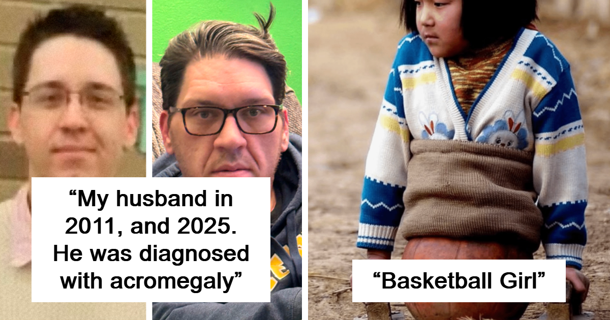 57 Fascinating Medical Cases That Might Leave You Amazed, Curious, And Slightly Nauseous