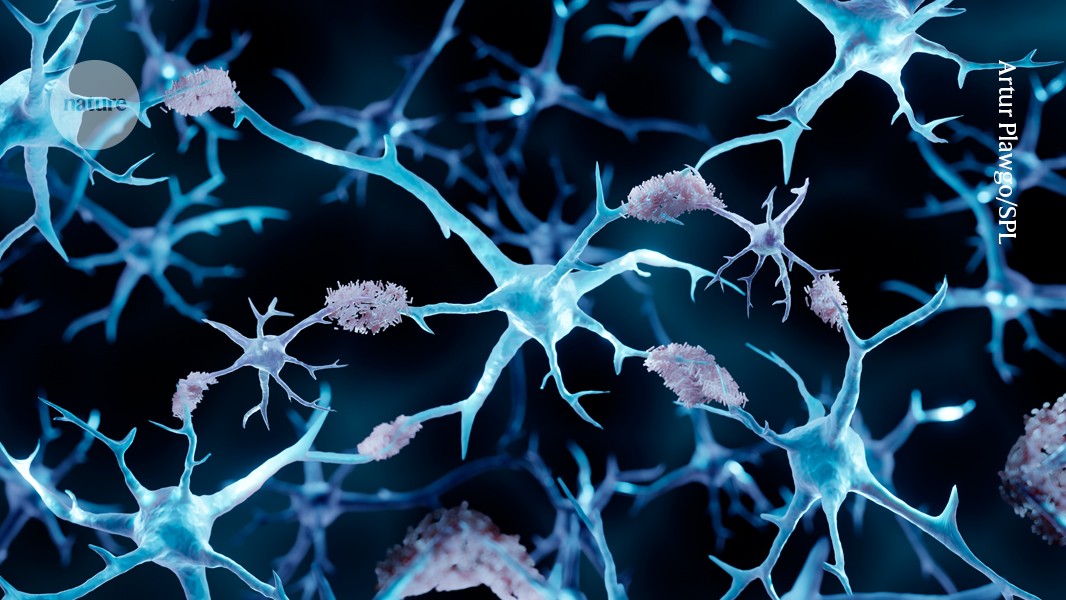 Cancer might protect against Alzheimer’s — this protein helps explain why