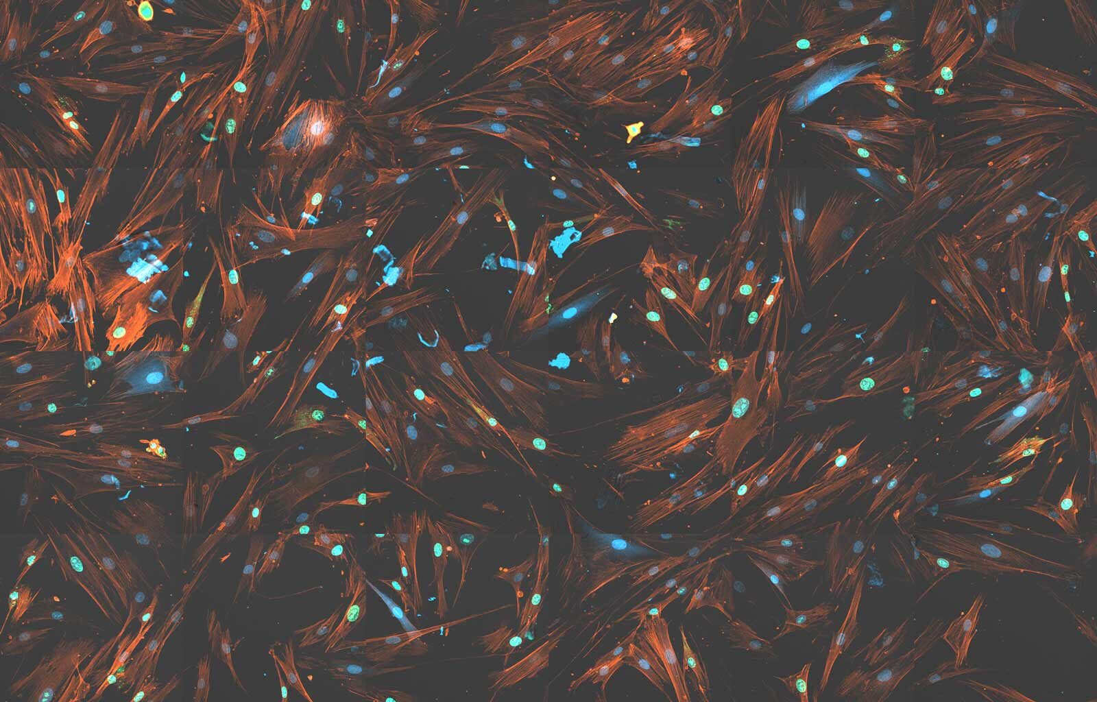 Tissue Repair Slows in Old Age. These Proteins Speed It Back Up