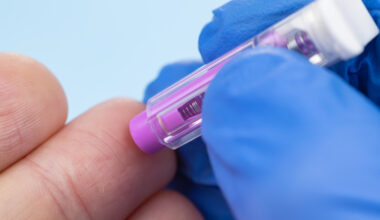 Major international research project underway for Alzheimer's diagnostic test