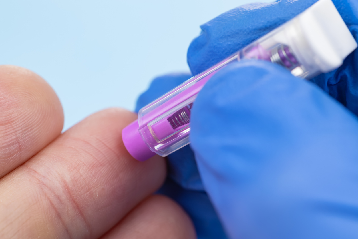 Major international research project underway for Alzheimer's diagnostic test