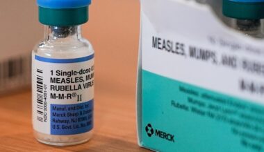 South Carolina confirms 124 new measles cases as outbreak on the Arizona-Utah line grows