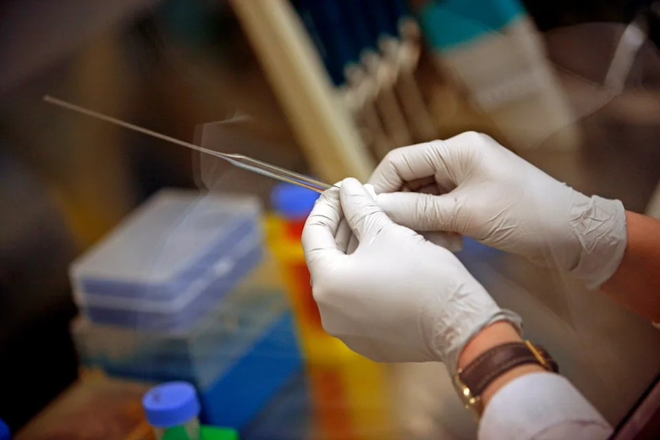 A new kind of stem cell therapy could help ease symptoms of people living with Parkinson’s disease, Southern California researchers say (Getty Images)