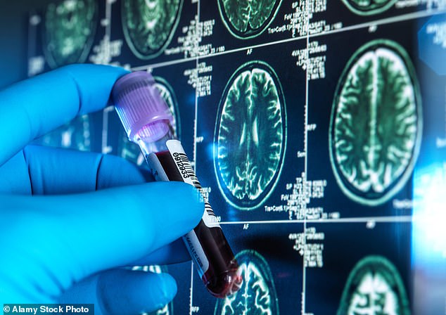 Dementia is Britain's biggest killer, and there are around 944,000 people in the UK living with the condition