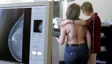 AI may help detect aggressive breast cancers earlier, researchers say
