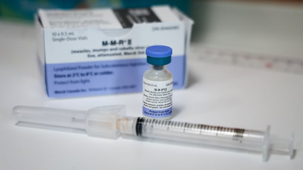 Indefinite measles exposure advisory issued for Parkland County