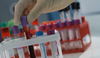 Canadian pediatricians call for cholesterol checks for kids as young as 2 to catch heart risks early