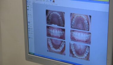 Why oral health is key to whole-body wellness
