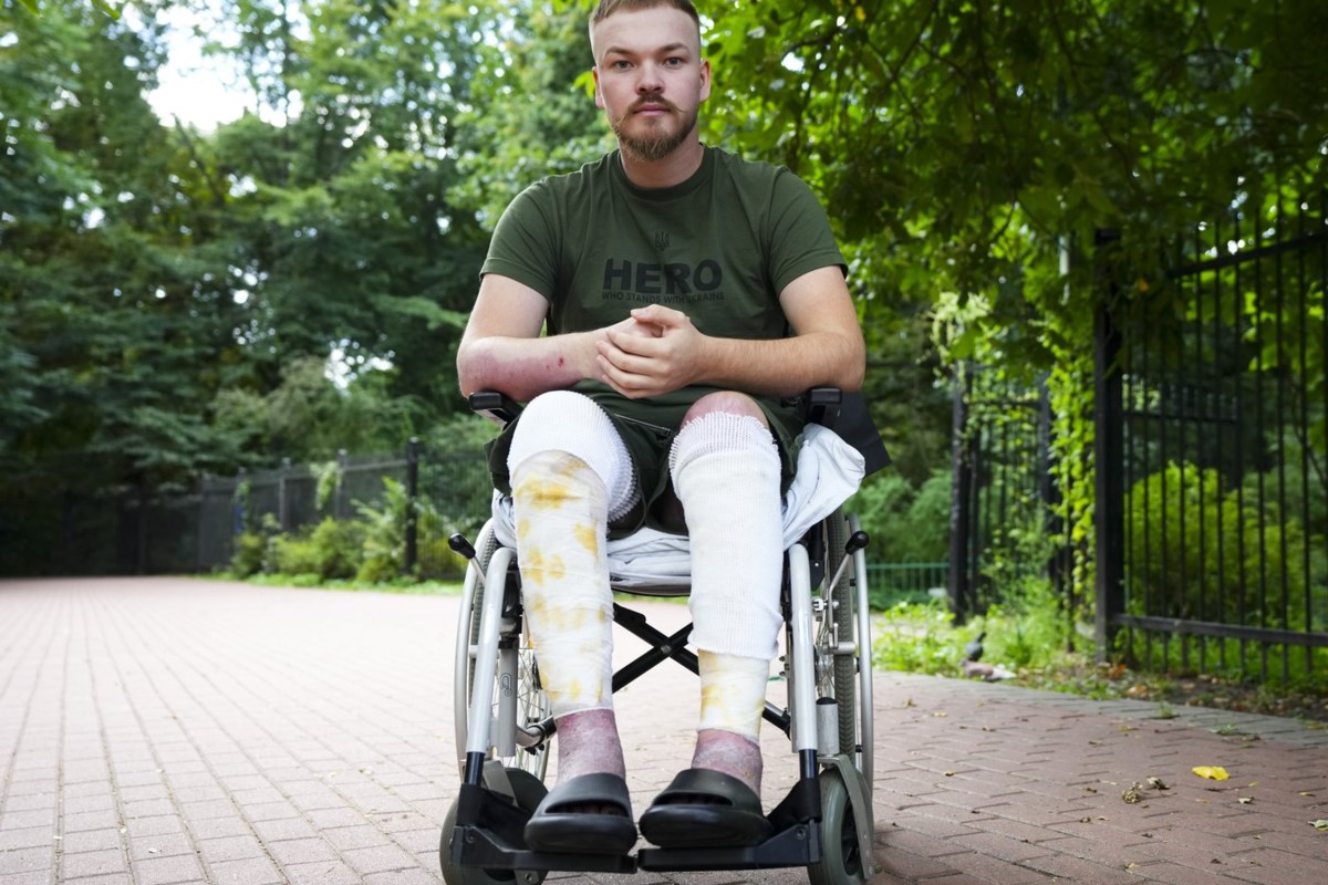 'Nothing's changing': Calgary man recovering in Ukraine sees no end to war