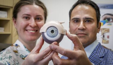 Ukrainian eye doctor training in Calgary to better help wounded