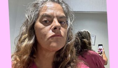 ‘I can hardly see colours. I’ve got cataracts’