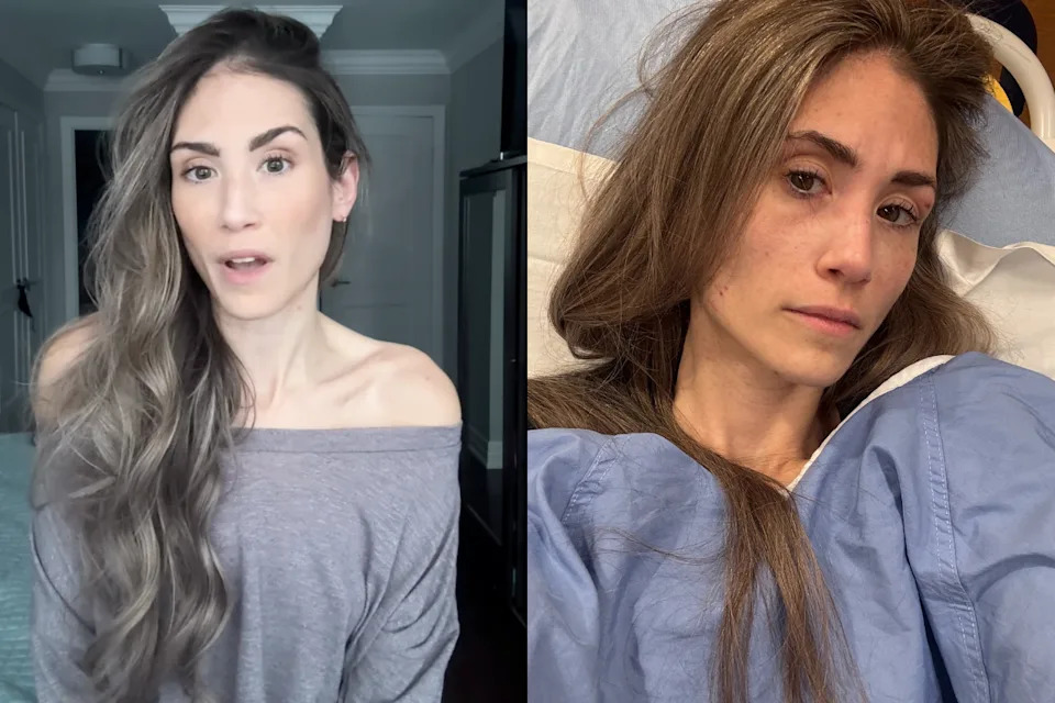 Jess Grossman, a model and entrepreneur from Toronto, is chronicling her rectal cancer diagnosis online. (Images via Instagram/@JessGrossman/JessGrossman)