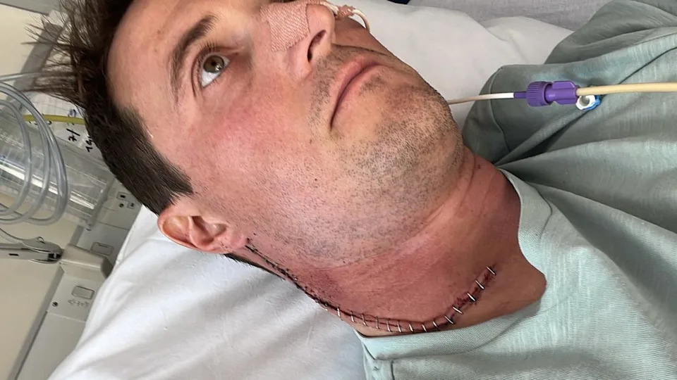 Anthony Perriam is sat down looking away from the camera. He has a large scar from surgery from his ear to the bottom of his neck.