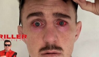 Tom Aspinall has eye surgery after UFC 321 double eye poke injury