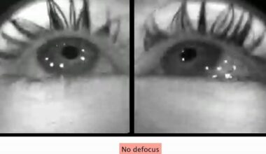 Study suggests short-sightedness caused by how we use our eyes indoors | Health