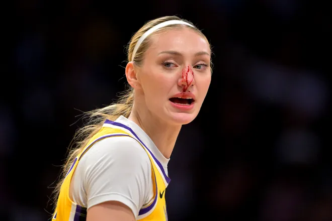 Los Angeles Sparks forward Cameron Brink left the game with a bloddy nose after going for a rebound in the first half against the Las Vegas Aces.