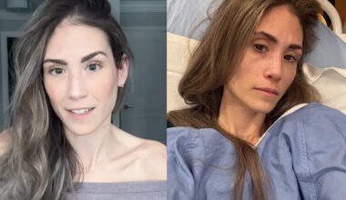 Toronto model Jess Grossman says an ER doctor 'brushed off' her pain. Then, she was diagnosed with rectal cancer