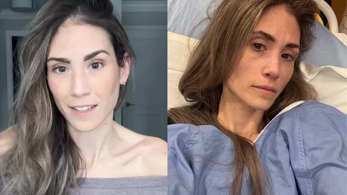 Toronto model Jess Grossman says an ER doctor 'brushed off' her pain. Then, she was diagnosed with rectal cancer