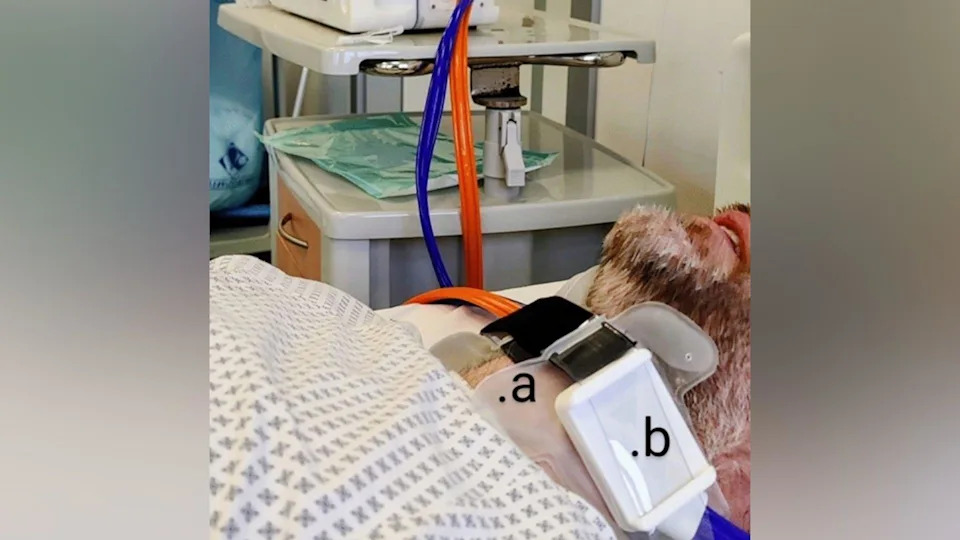 A close up of a male patient who is lying on his back on a hospital bed, wearing the collar. It is wired up to a machine with two cables - bright orange and bright blue. The patient has a beard and his lips are parted, but you can't see the rest of his face.