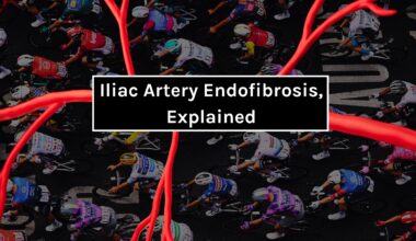 Understanding iliac artery endofibrosis