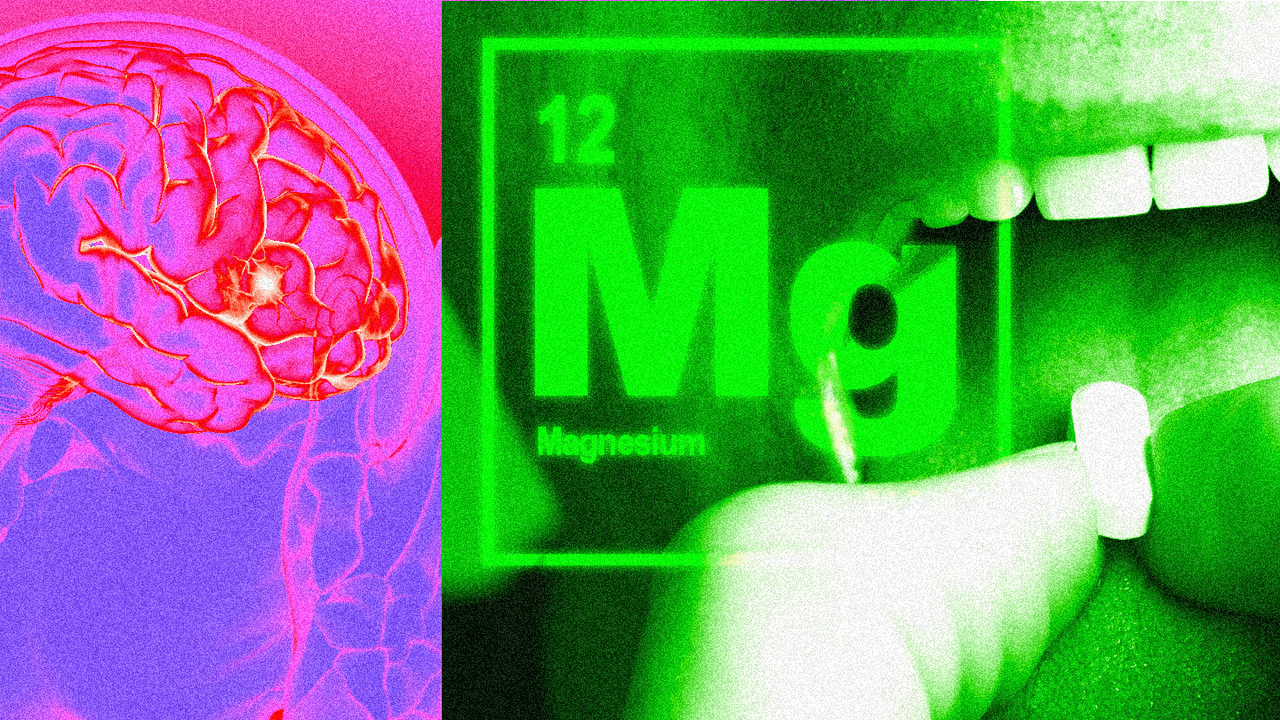 Magnesium for Migraines: How the Nutrient Can Help