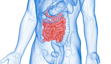 Transparent image of a human torso showing inflamed small intestine, as seen in Crohn's disease patients