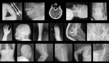 Even the Hospitals Aren’t Safe in Iran