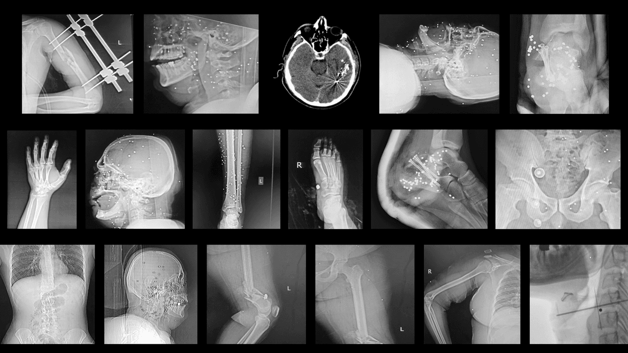 Even the Hospitals Aren’t Safe in Iran