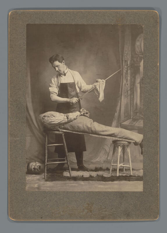 A vintage black-and-white photo shows a person in an apron holding a cloth and saw, standing beside another person lying on a table with their head appearing detached and on the floor, creating an illusion.