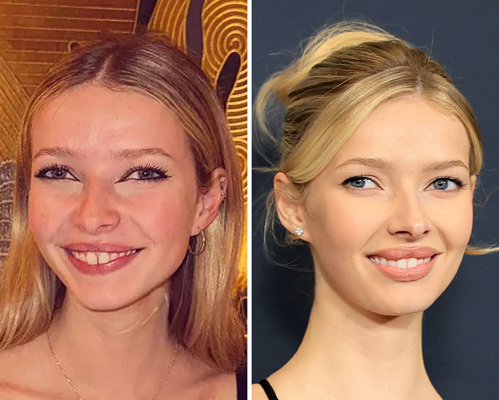 Apple Martin in two side-by-side portraits showing her before and after cosmetic procedures, smiling in both images Apple Martin in two side-by-side portraits showing her before and after cosmetic procedures, smiling in both images