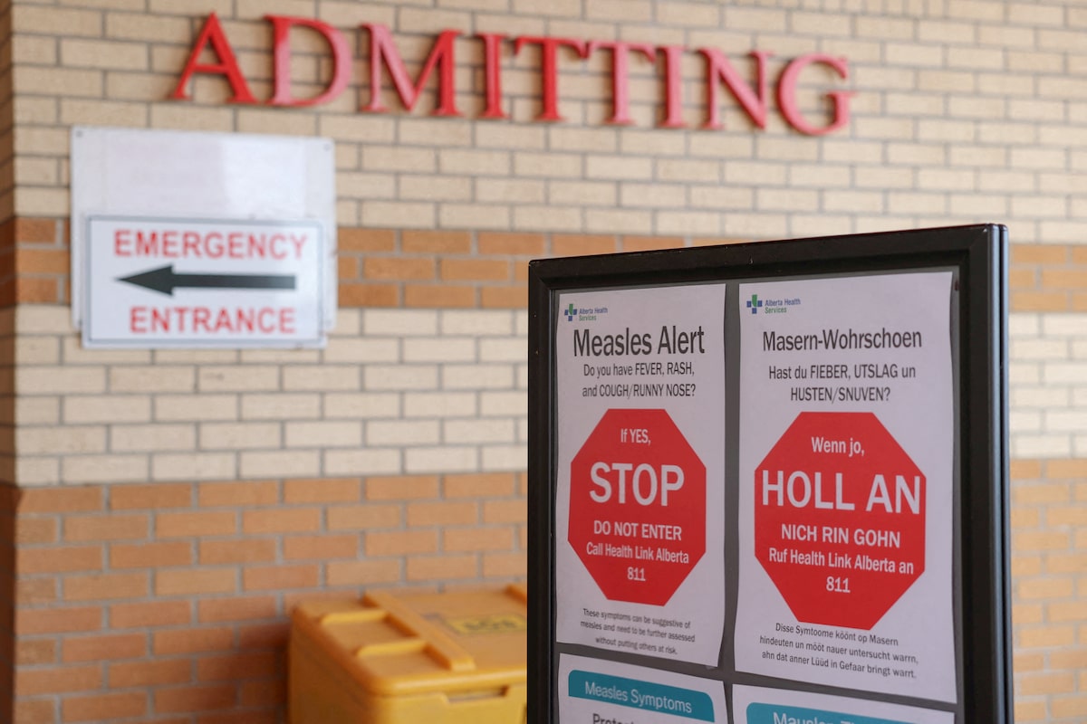 Death of premature Alberta baby with measles was not made public for months, documents show