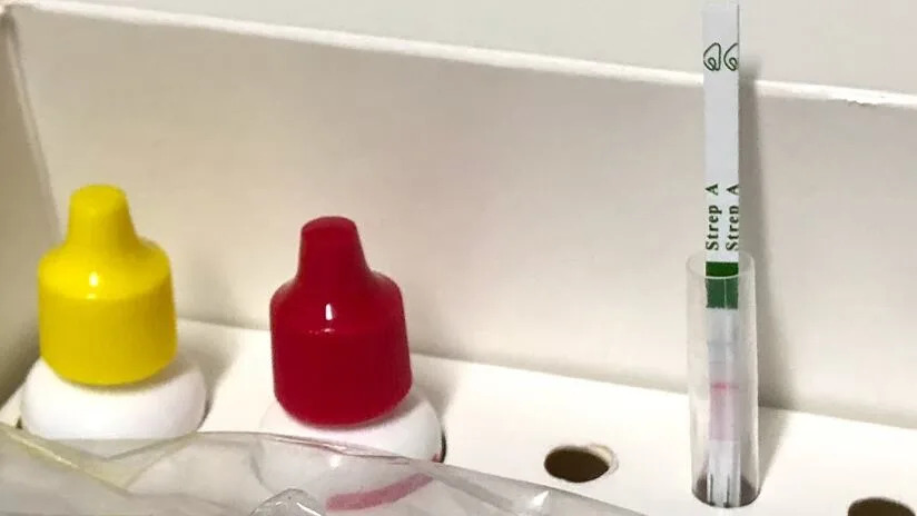 A rapid strep test is used to diagnose bacterial pharyngitis caused by group A streptococci, or strep throat.