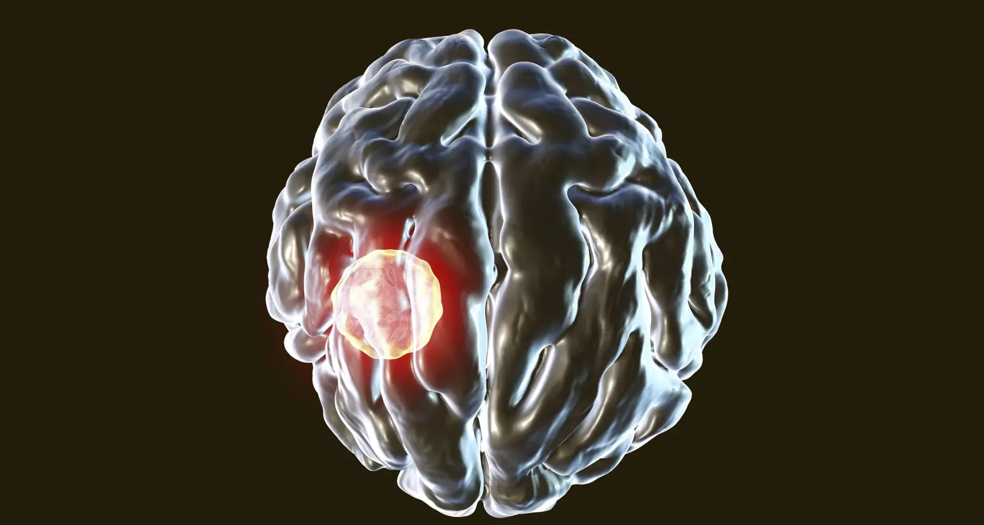 One in three people carry this brain parasite but the body has a kill switch